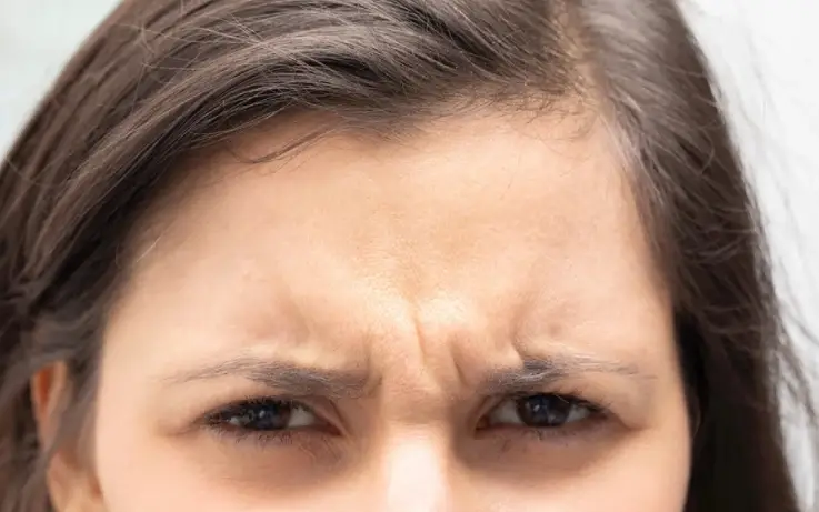 Always looking angry?? Get Rid of your Frown lines!! | Skin Decor