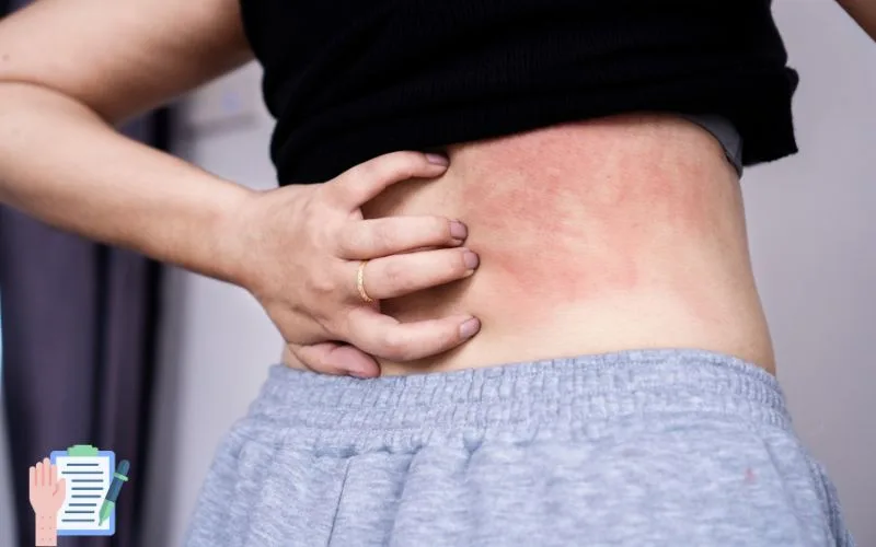 Skin Allergy Types and Treatment Dermatologist in Dwarka, Delhi