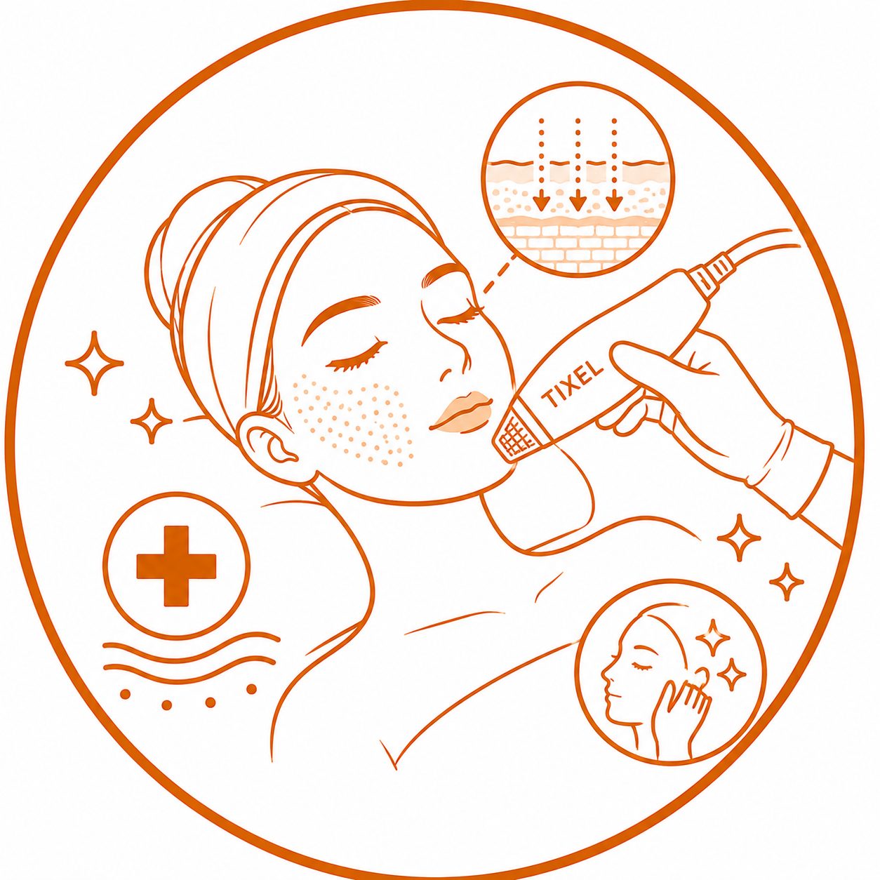Tixel Treatment