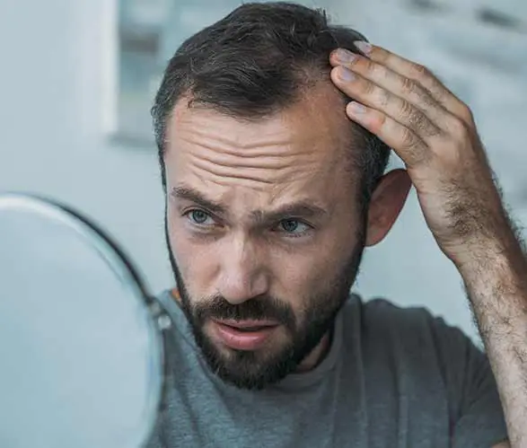 Hair Fall Treatment in Dwarka