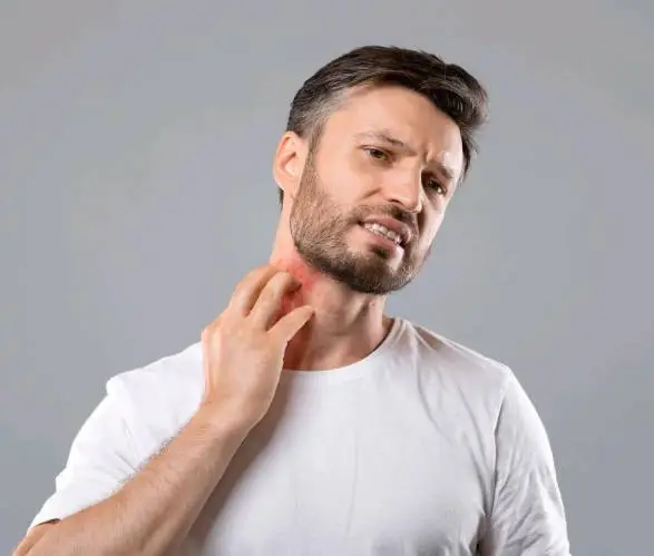 Eczema Treatment in Dwarka